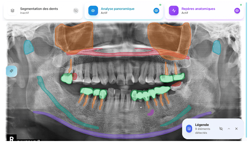 Analyse panoramique IA - Interface d'analyse radiologique